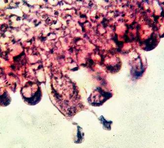 Coprinus basidium with attached basidiospores