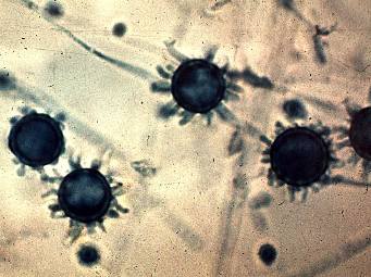 Histoplasma capsulatum macroconidia and microconidia