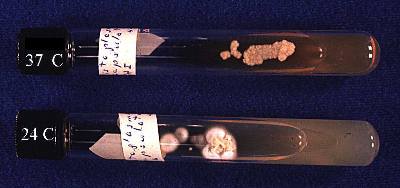 Histoplasma capsulatum yeast and mycelial cultures at different temperatures