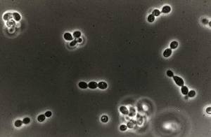 Histoplasma capsulatum yeast form