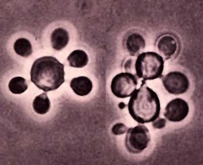 Paracoccidioides brasiliensis yeast form