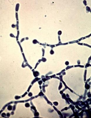 Paracoccidioides brasiliensis mycelium and lollipop conidia or aleurioconidia