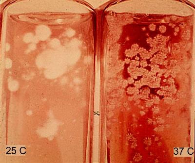 Paracoccidioides mycelium and yeast forms in culture