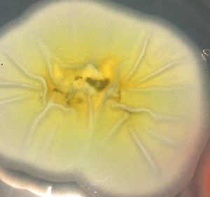 the same Penicillium chrysogenum colony, reverse side, exuding yellow chrysogenin pigment, an indicator of good penicillin yields