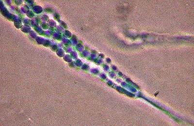 young conidiophore of Penicillium chrysogenum