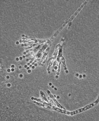 Penicillim chrysogenum, aka P. notatum, from a direct descendent of Fleming's strain