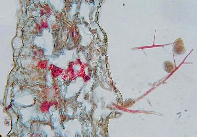 Phytophthora infestans sporangium with knees