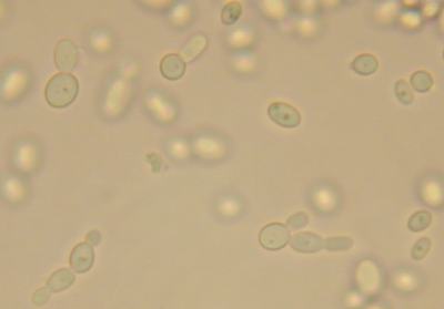 Saccharomyces cerevisiae budding