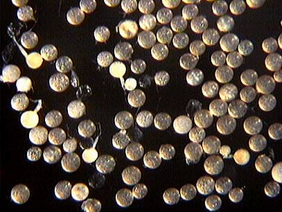 Acaulospora scrobiculata spores from http://invam.caf.wvu.edu/fungi/taxonomy/Acaulosporaceae/Acaulospora/scrobiculata/scrobiculata.htm