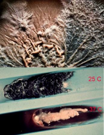 upper pic--Sporothrix colony, morphing from fuzzy mycelium to slimy yeast.  lower pic colonies grown at the indicated temperature